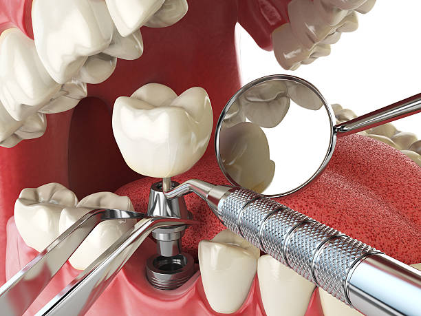 Best Emergency TMJ Treatment in Richland, PA